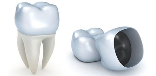 Dental-Crowns-Image