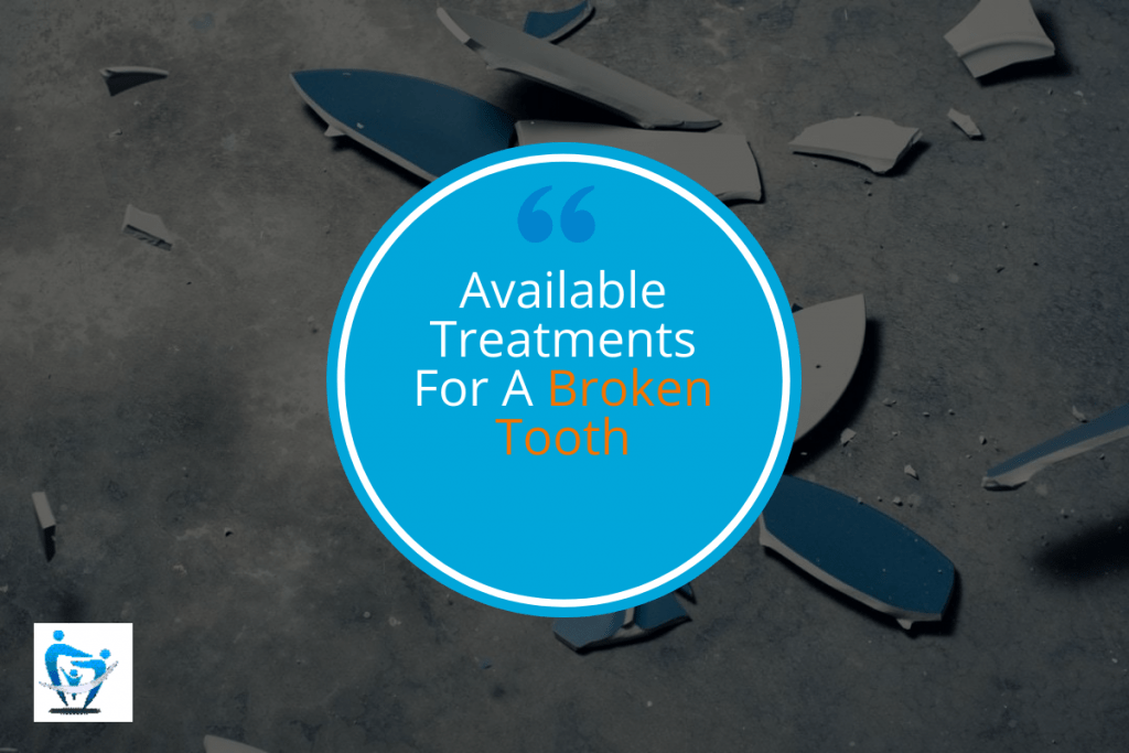 Available Treatments for a Broken Tooth