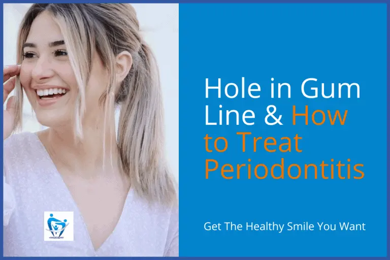 hole in gum