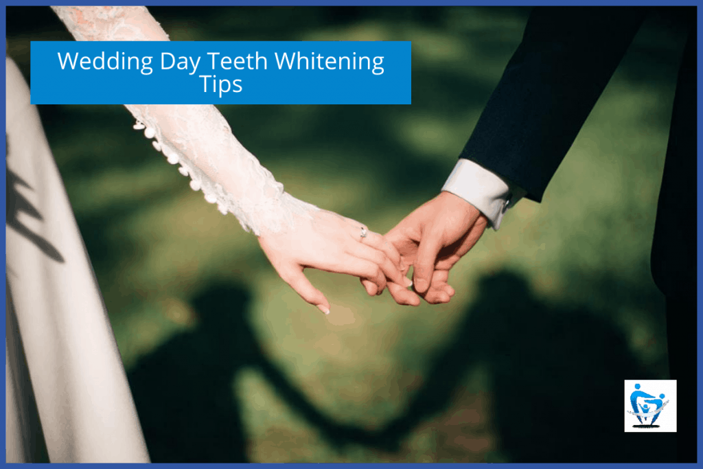 Wedding Day Teeth Whitening Tips