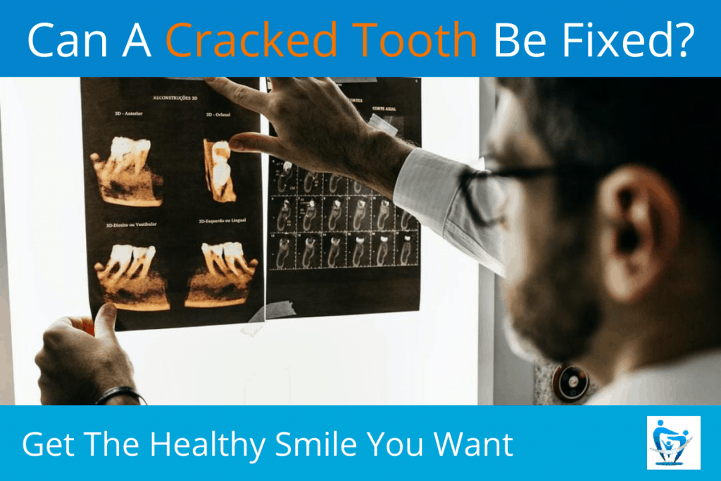Can a Cracked Tooth Be Fixed?