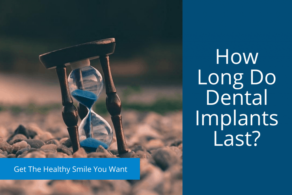 How Long Do Dental Implants Last?