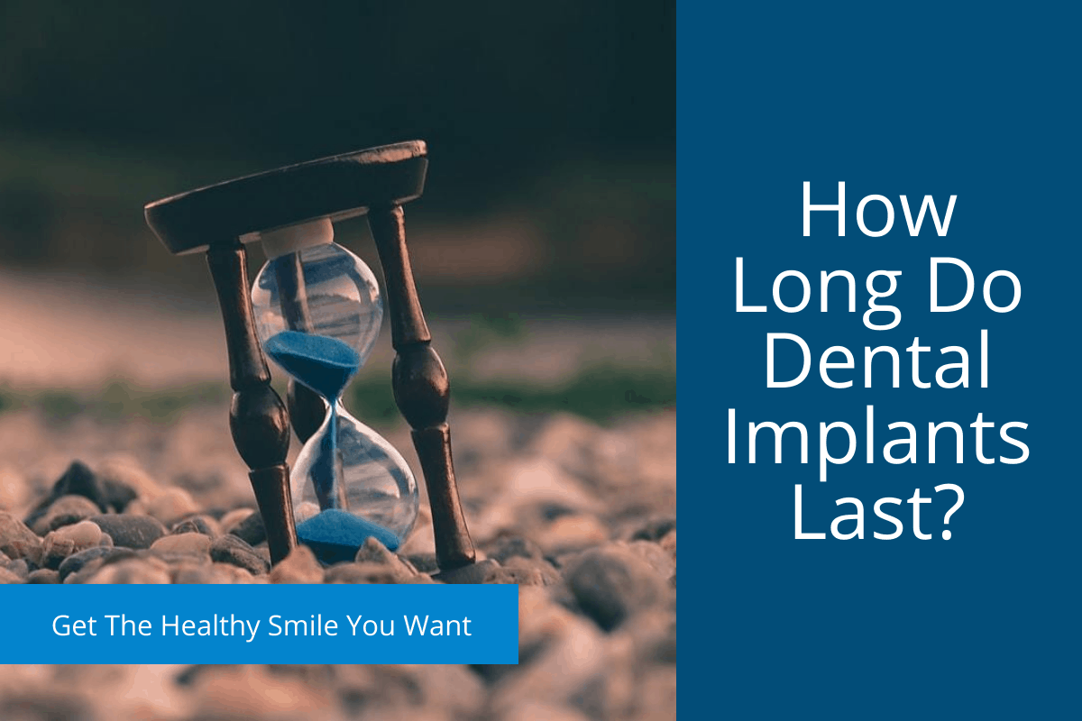 How Long Do Dental Implants Last? Your Healthy Smile