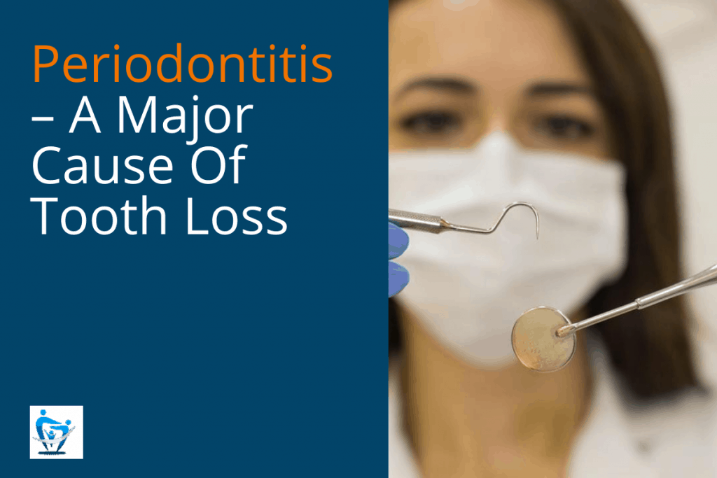 Periodontitis – A Major Cause Of Tooth Loss