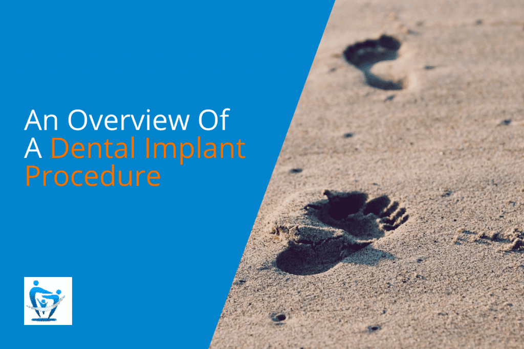 An Overview Of A Dental Implant Procedure