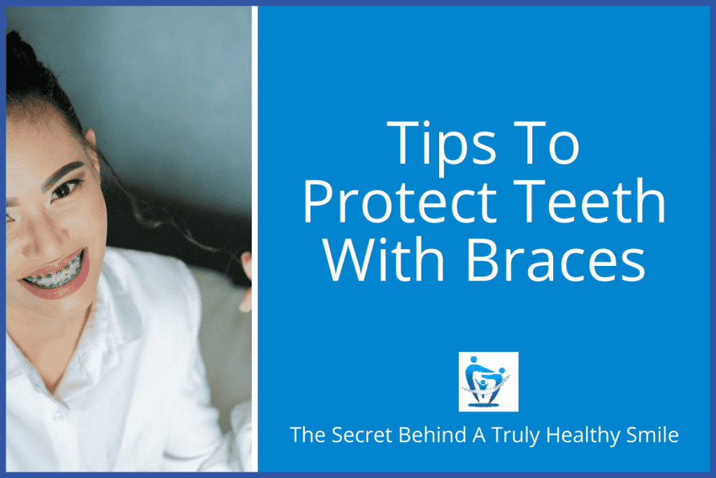 Tips to protect teeth with braces
