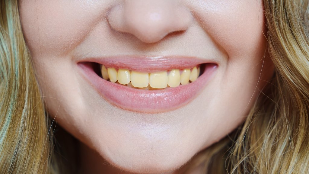 teeth yellow