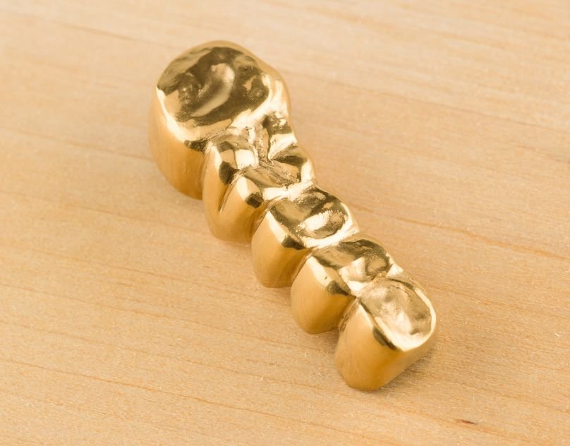 Does It Hurt To Get A Dental Crown