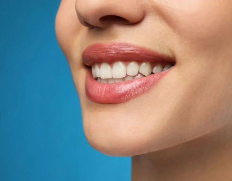 Teeth Whitening Cost