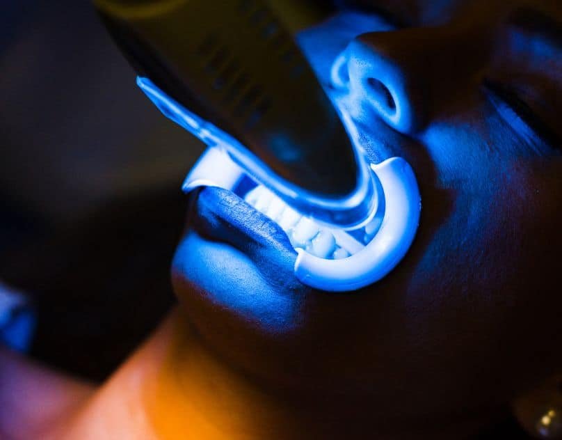 teeth whitening