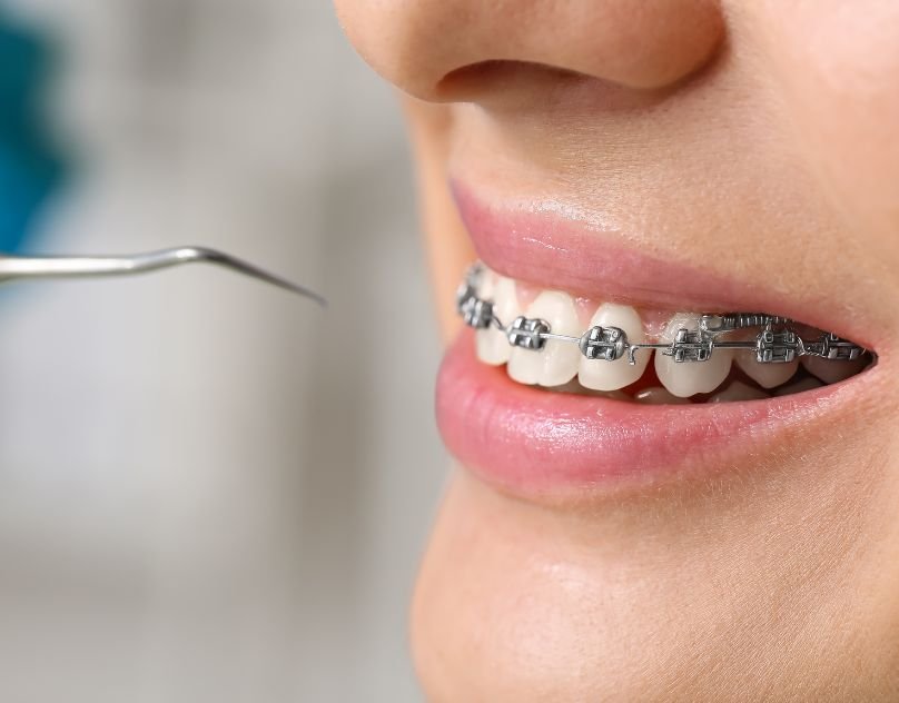Orthodontic