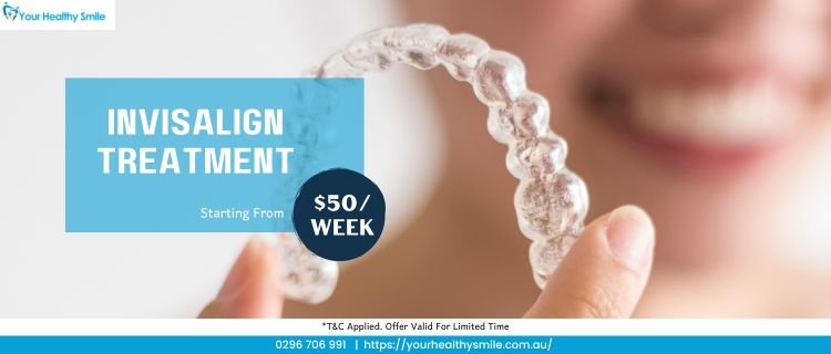 Dental Implants (2)