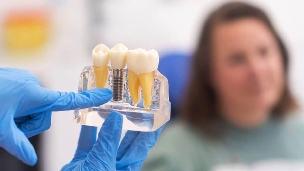 Types of Dental Implants