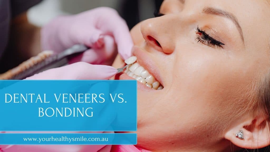 Dental Veneers vs. Bonding
