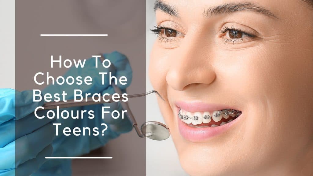 How To Choose The Best Braces Colours For Teens?