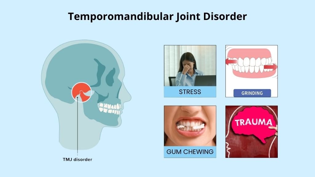 tmj disorder