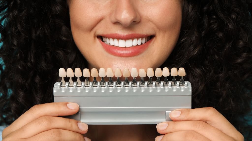 dental veneers cost