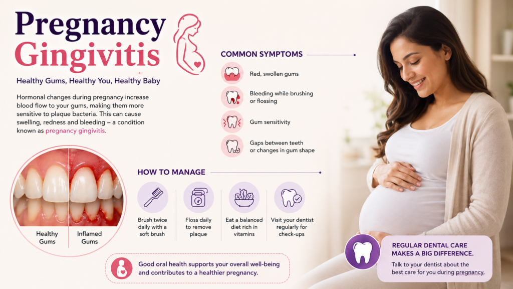 pregnancy gingivitis